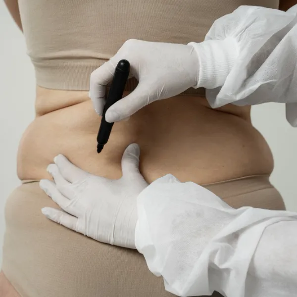 how much is coolsculpting