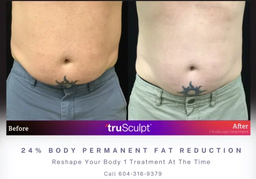 True Body Sculpt for a Masculine Shape